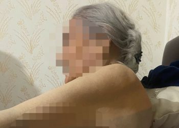 Ankara’da bakıcı dehşeti: 91 yaşındaki kadın hastaneye kaldırıldı