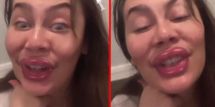 Demet Evgar, botoks ve dolguyu fazla kaçıranları ti’ye aldı