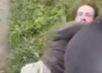 İngiltere’deki baba, kızı ile buluşan adama köpekle saldırdı