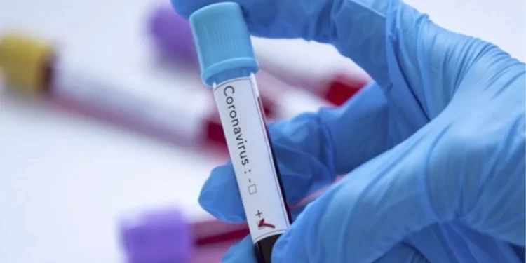 Eris nedir? Yeni Covid varyantı Eris öldürücü mü?